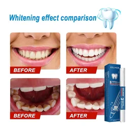 Dentes Whitening Pen Repair Remover Placa De Melanina Amarela 7 Dias Rápida Tooth Cleaning Dentes Ferramentas Tratamento Placa Beleza Saúde