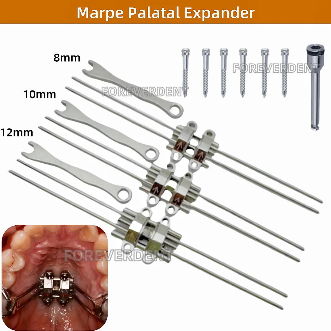 MSE Dental Marpe Palatal Maxillary Skeletal Expander Orthopaedic Mid Facial Parallel Expansion Screw Rod Appliance