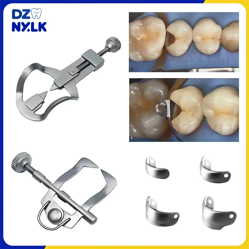 

Dental Matrix Bands Anterior/Posterior Tooth Divider Separator Retractor Retainer Orthodontic Matrix Rubber Dam Dentist Tools