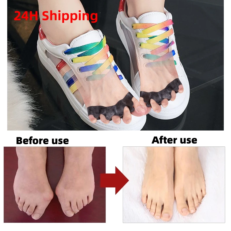 2Pcs=1Pair Black Orthopedic Product Silicone Separator Gel Toe Protector Bunion Corrector Foot Finger Straightener Pedicure Tool