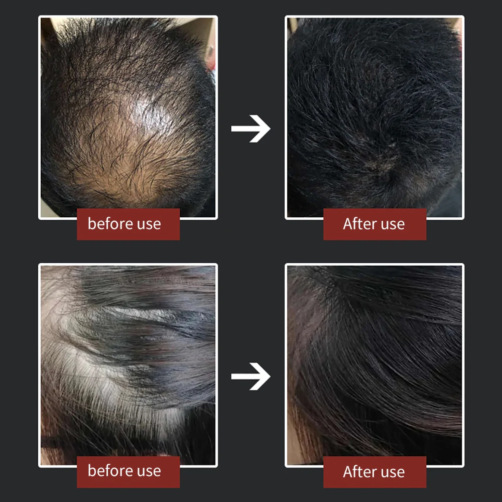 Natural Keratin Hair Fiber 27.5g Men Hair Growth Powder Authentic Hair Fibers Hair Building Powder Hair Growth Thickening Spray