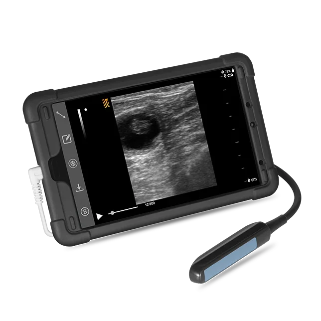 Best Sale Portable B/W Android Veterinary Ultrasound Probe For Livestock