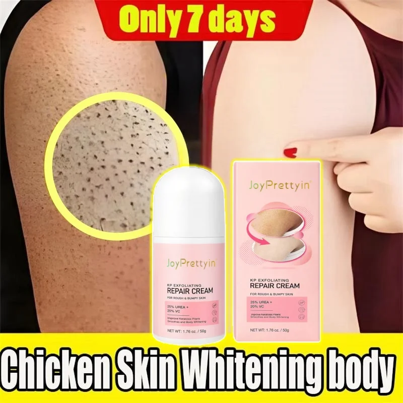 

Keratosis Pilaris Repair Treatment Cream Exfoliating Removal Chicken Skin Cleaning Acne Spots Moisturizing Smooth Body Skin Care