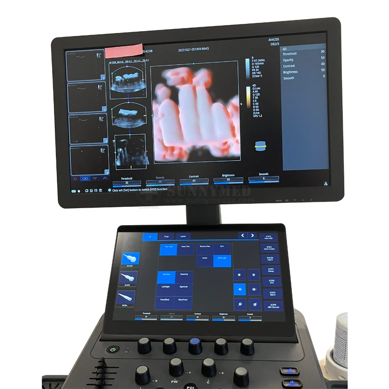 SYA-D40 نظام عربة الموجات فوق الصوتية شاشة لمس ثلاثية الأبعاد/4D