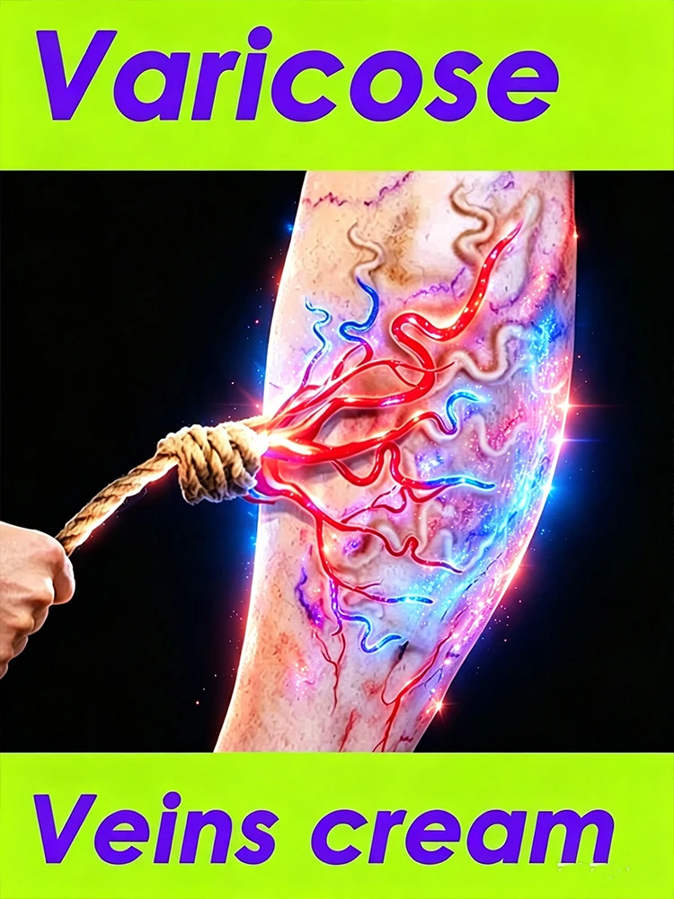 Herbal Varicose Veins Cream Leg Care Cream