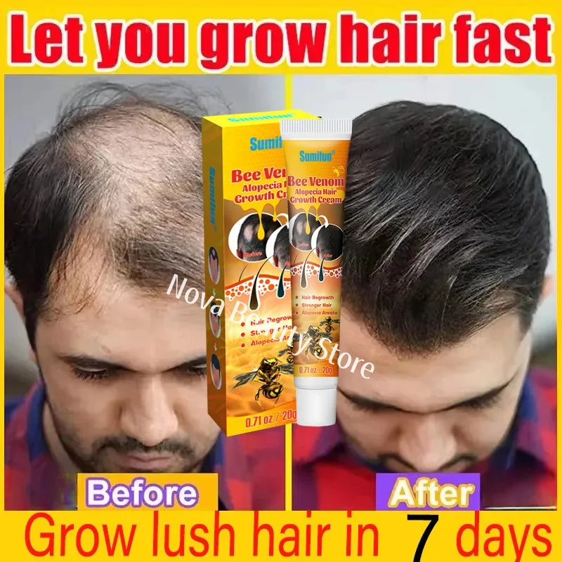 

Hair Growth Cream 7 Days Fast Regrowth Essential Capsule Anti Hair loss Baldness Repair Damaged Scalp Treatment For Women Men