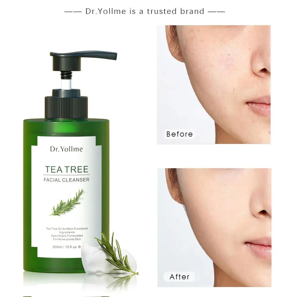 

300ml Tree Tea Facial Cleanser Mild Non Irritating Cleanser Repairing Cleansing And Pores Barrier Facial Moisturizing I9H7