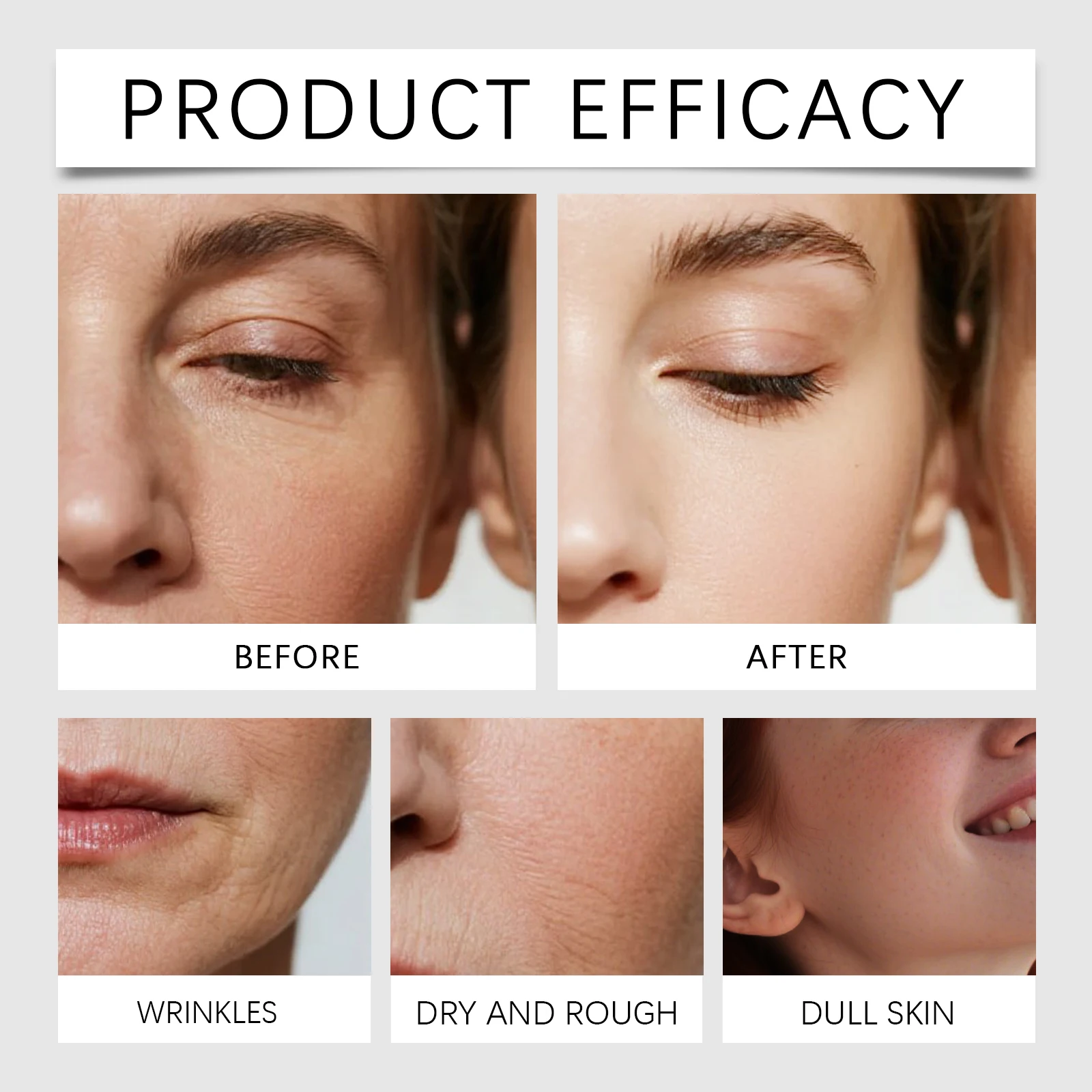 Thumbnail 2 - #5 Acne Treatments & Kits Deals & Discounts