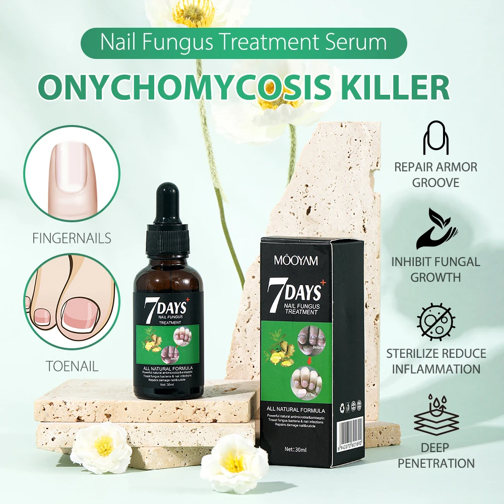 Nail Fungal Essence Ginger Extract Repair Serum Treatment Strengthener Nail For Beauty Glowing Nail