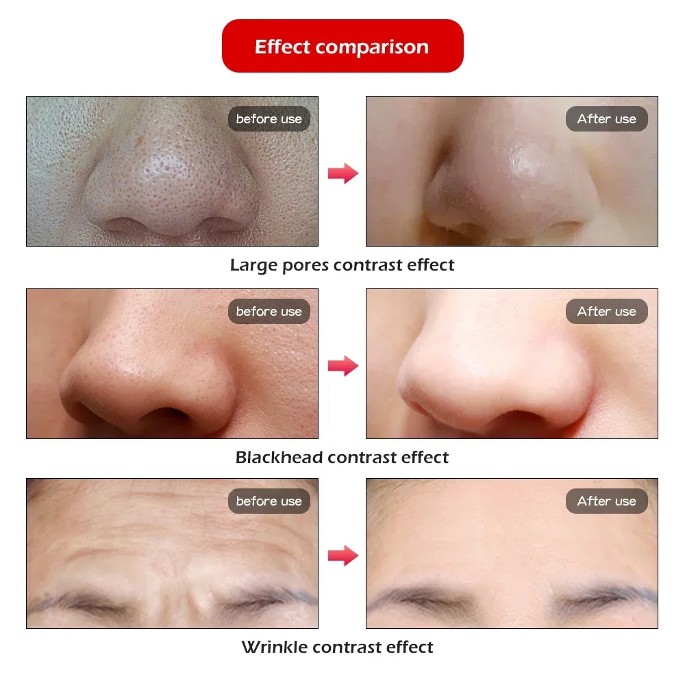 Seven color spectrometer Facial Beauty Massage Device Electric Face Clean Massager Face Care Skin Rejuvenation Beauty Machine