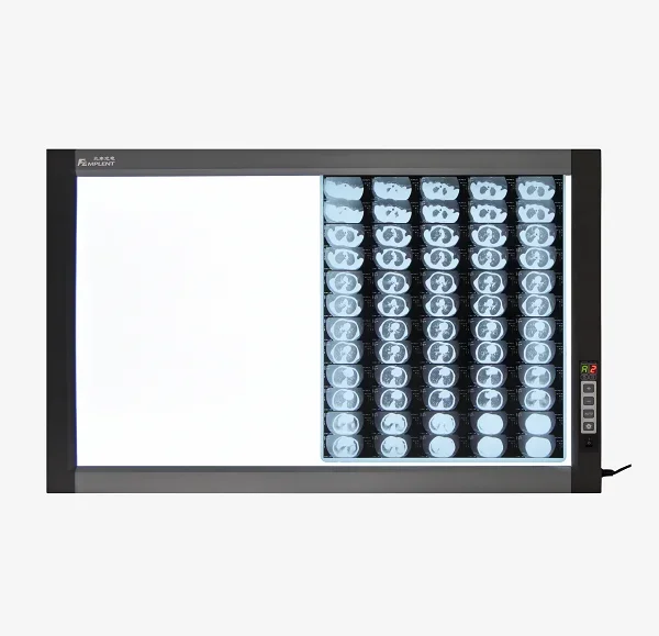 Profession elle wirtschaft liche Krankenhaus Bagihrte Röntgen Röntgen Visionneuse de film Negatos kop Röntgen HFZG-D