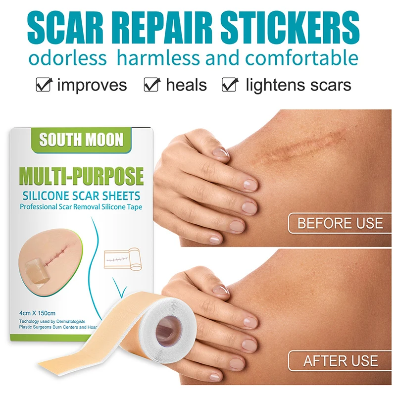 Silicone Scars Patches Surgery Corrector Scar Tap Removal Sheet Healing Patch Skin Wounds Band Acne Burn Treatment Sticker