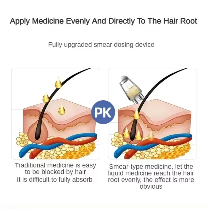 أداة توزيع فروة الرأس 6 مل، مدلك صغير للرأس، فرشاة دوارة، أداة توزيع زيت نمو الشعر، مشط تدليك مدلك الرأس