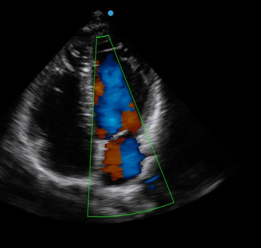 SY-A2300 Cardiac Diagnosis Portable Ultrasound , Excellent Image 3D 4D Echo Machine