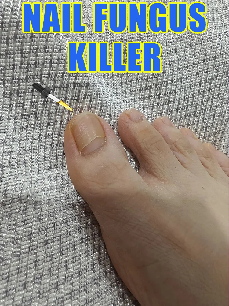 

2025 Toenail Fungus Patch Waterproof Nail Repair Patches Nail Ingrown Correction Sticker Discolored Damaged Nail Foot Care Tool