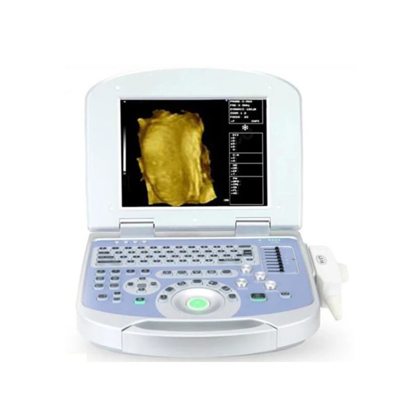 GooDoctor Notebook Full Digital Ultrasonic System Various Probe Interfaces Medical Use Human Ultrasound Machine