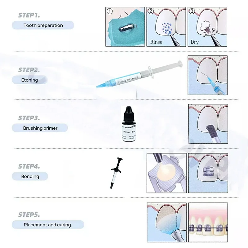 Original Dental Light-Cure Orthodontic Adhesive Kit  Bracket Bonding Resin Primer Band Cement Glue Bonding Repair Lab Material view 6