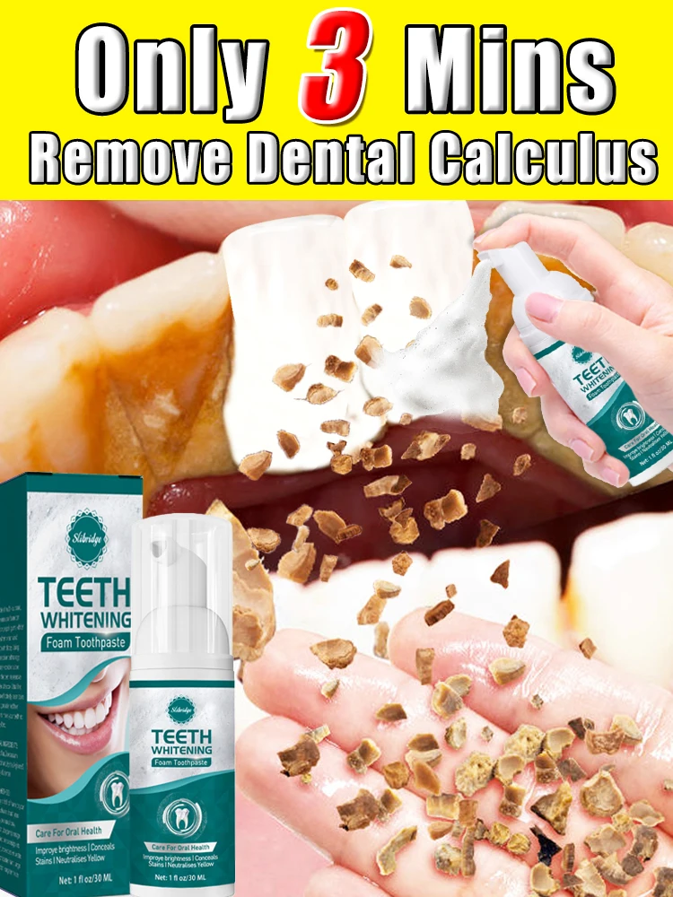 Eliminador de cálculo dental Mousse blanqueadora de dientes Limpieza Higiene bucal Eliminación Halitosis Manchas de placa Cuidado del aliento fresco