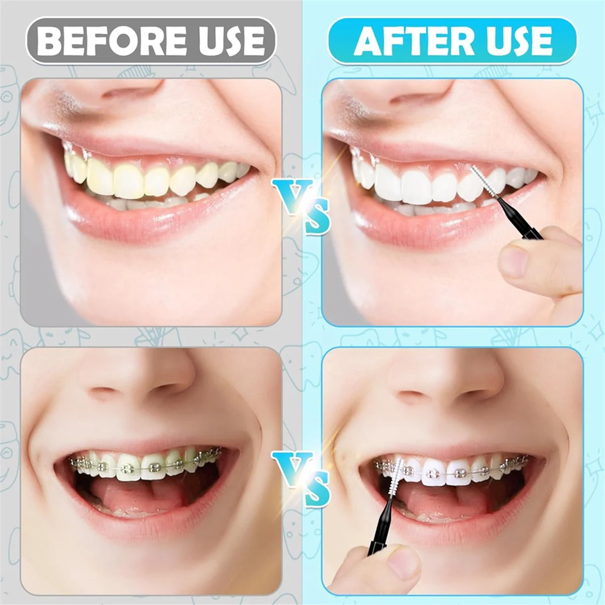 120pcs Interdental Brushes, Braces Brush Cleaner for Teeth Cleaning Tools Spiral Dental Brush for Efficient Oral Care A