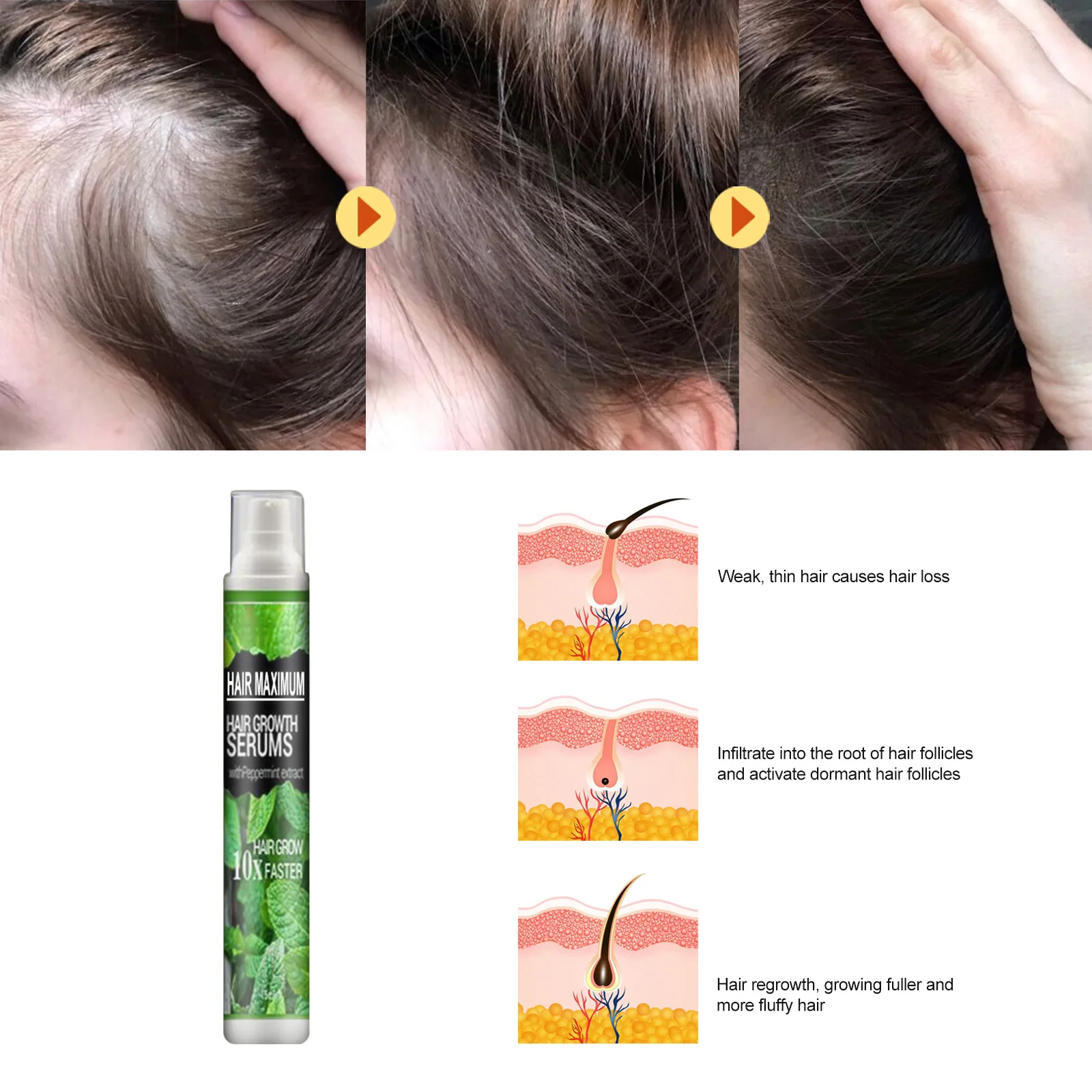 Spray liquide anti-chute pour cheveux épais, soin à base de plantes, huile essentielle, 10ml