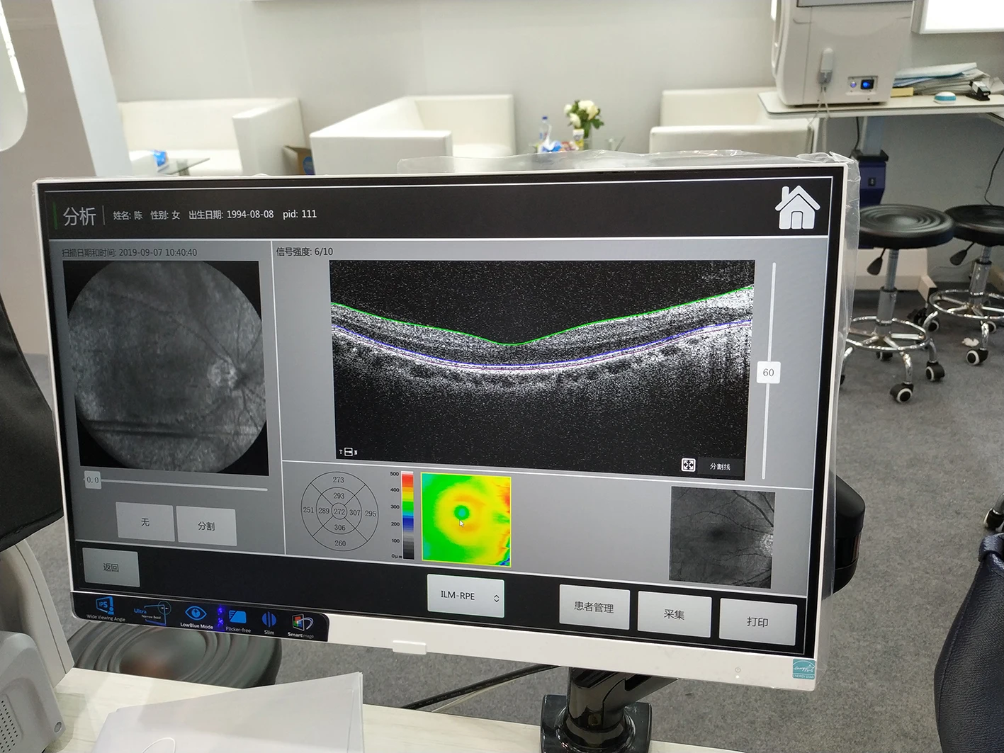 SHTOPVIEW الجزء الخلفي للعين OCT التصوير التوافق البصري مع Retiview الكمبيوتر المدمج 500