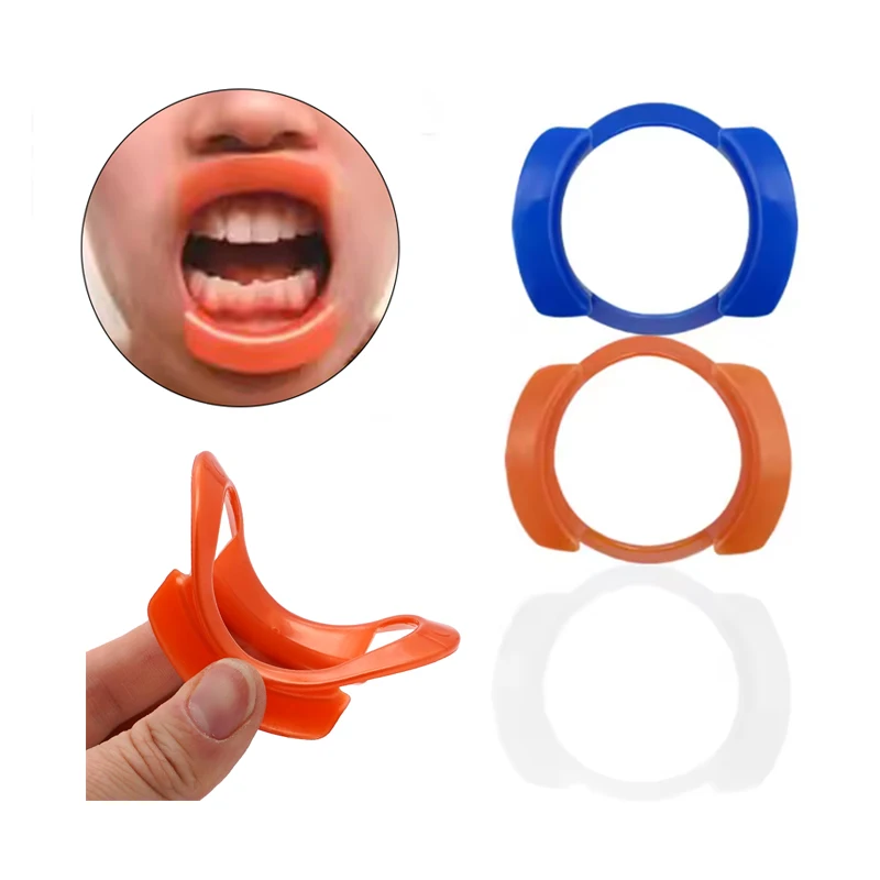 10 Pcs Dental O-Shape Mouth Opener Intraoral Cheek Lip Retractors Mouth Spreader Expanders Orthodontic Materials Dentistry Tools