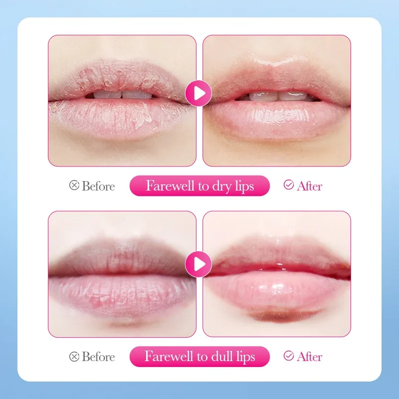 الخوخ الطبيعي - مقشر الشفاه بنكهة - يزيل البشرة الجافة بلطفًا ويغذي ومرطبًا للشفاه المرنة #3