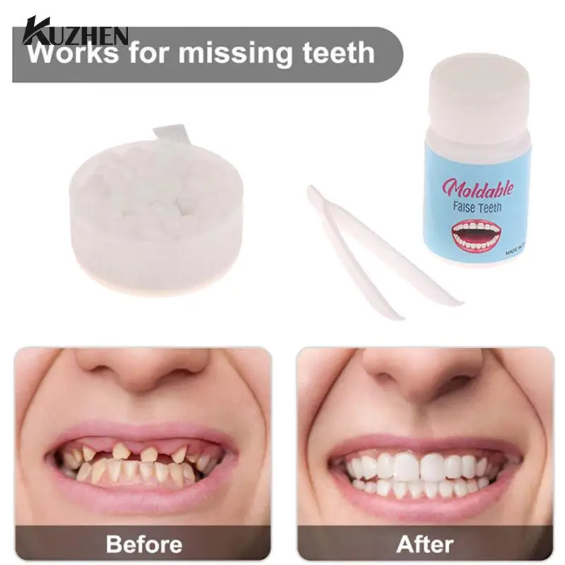 Resin 10g/15g/20g Temporary Tooth Repair Kit Teeth And Gaps FalseTeeth Solid Glue Denture Adhesive Teeth Whitening Tooth Beauty