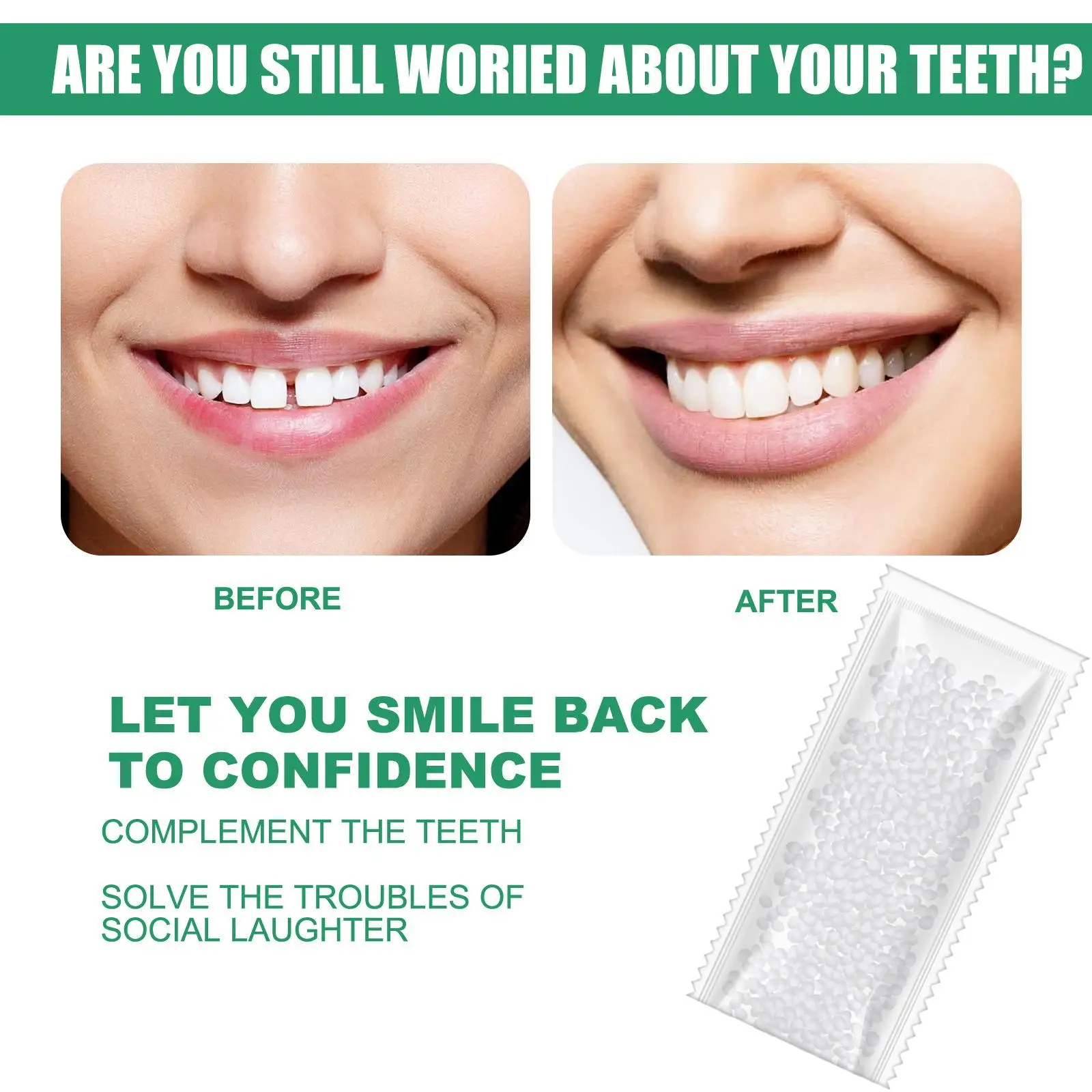 Kit de fijación dental temporal de cuentas térmicas de relleno dental de ajuste instantáneo para Dental