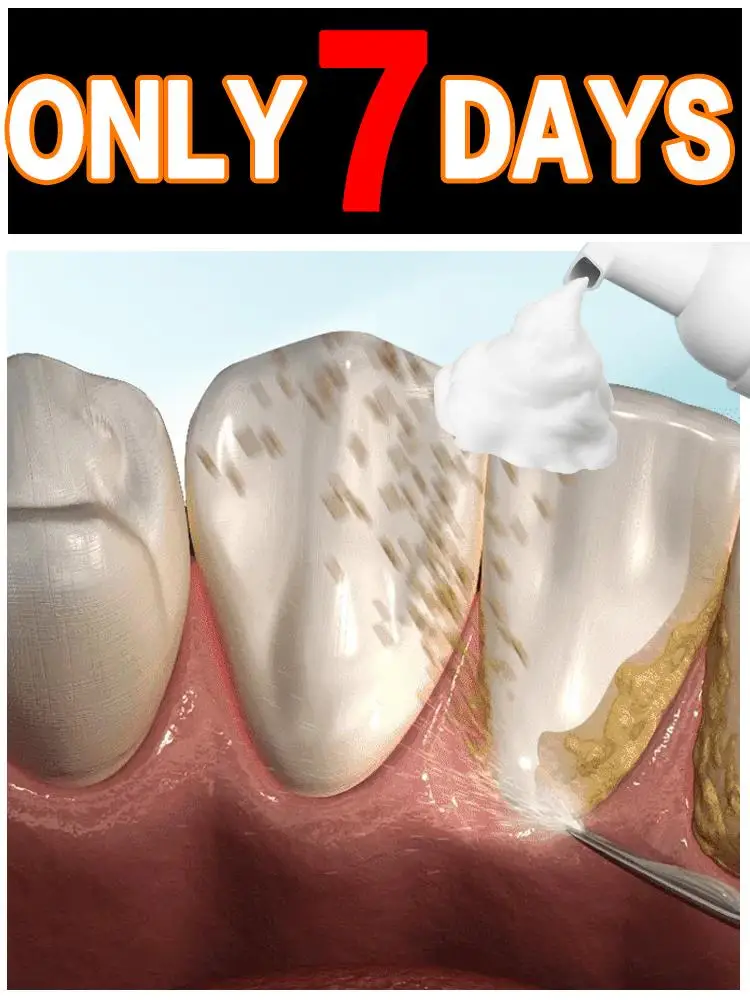 Reduce tartar, intraoral, comfortable and appropriate, facilities à utiliser