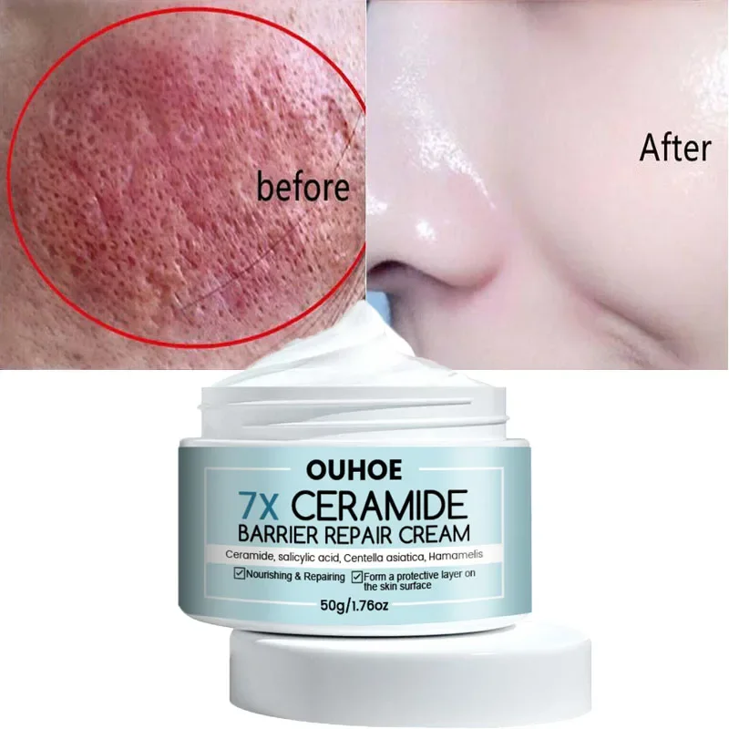 7 Day Face Rosacea Treatment Cream Collagen Intense Repair Redness Dry Sensitive Itching Skin Moisturize Sooth Korean Cosmetics