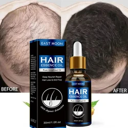 Óleo de alecrim para o crescimento do cabelo, solução sérica para homens e mulheres, tratamento rápido para barba, produto poderoso, 30ml