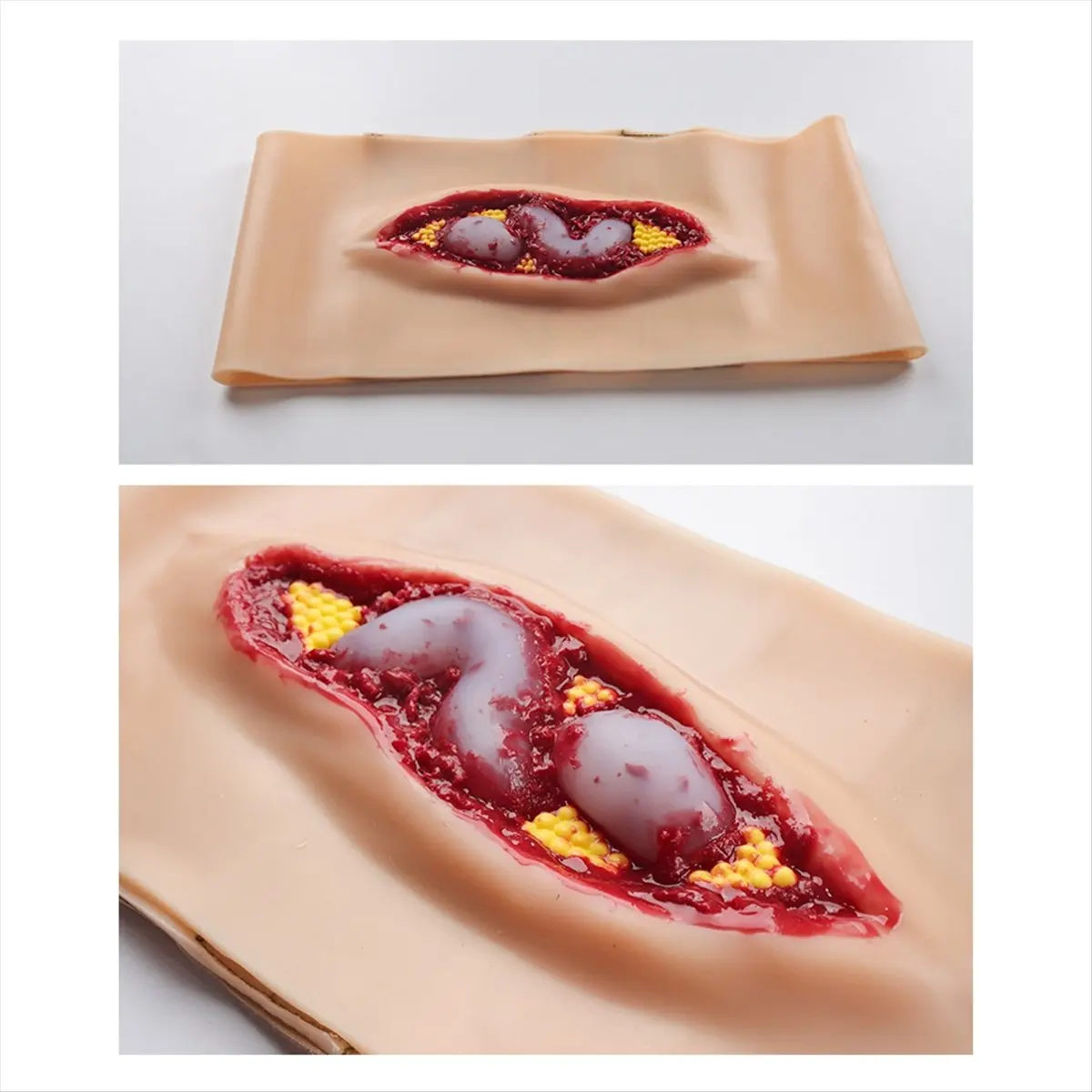 STOCK-New Abdominal Anatomy Wound Training Model for Medical Teaching and Training, an Emergency Simulation Model Can Worn