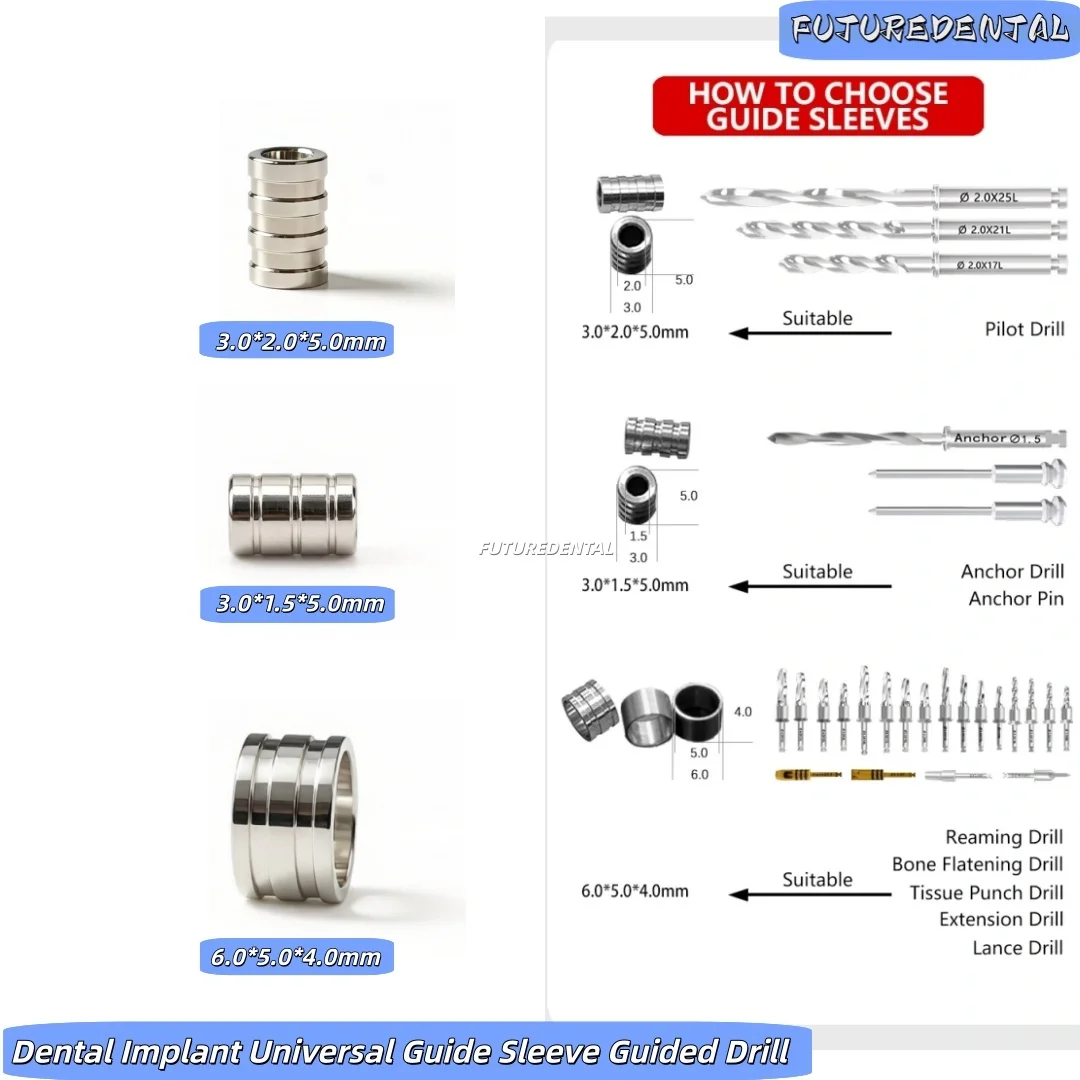 Dental Implant Guide Sleeve Kit - 3 Sizes Universal Drill Guide for Pilot, Anchor, Lance & Reaming Drills