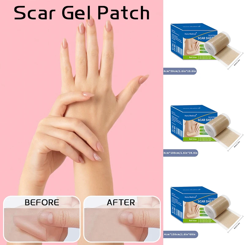 1roll Tattoo Scar Tape Painless Effective for C-Section Keloid Surgery Burn Acne Cover up Waterproof Stickers Scar Repair Tools