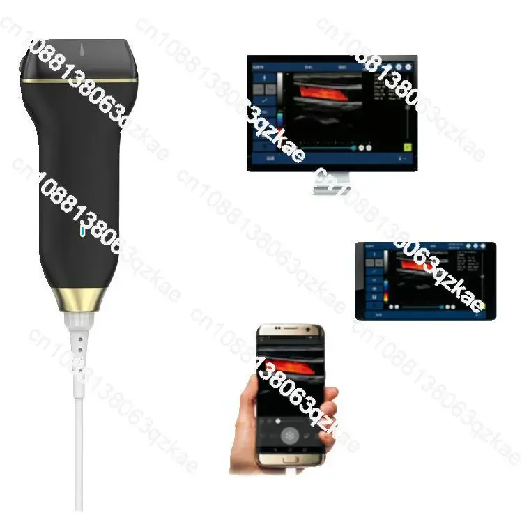 China Handheld Pocket USB Color Doppler linear probe ultrasound handheld portable ultrasound device