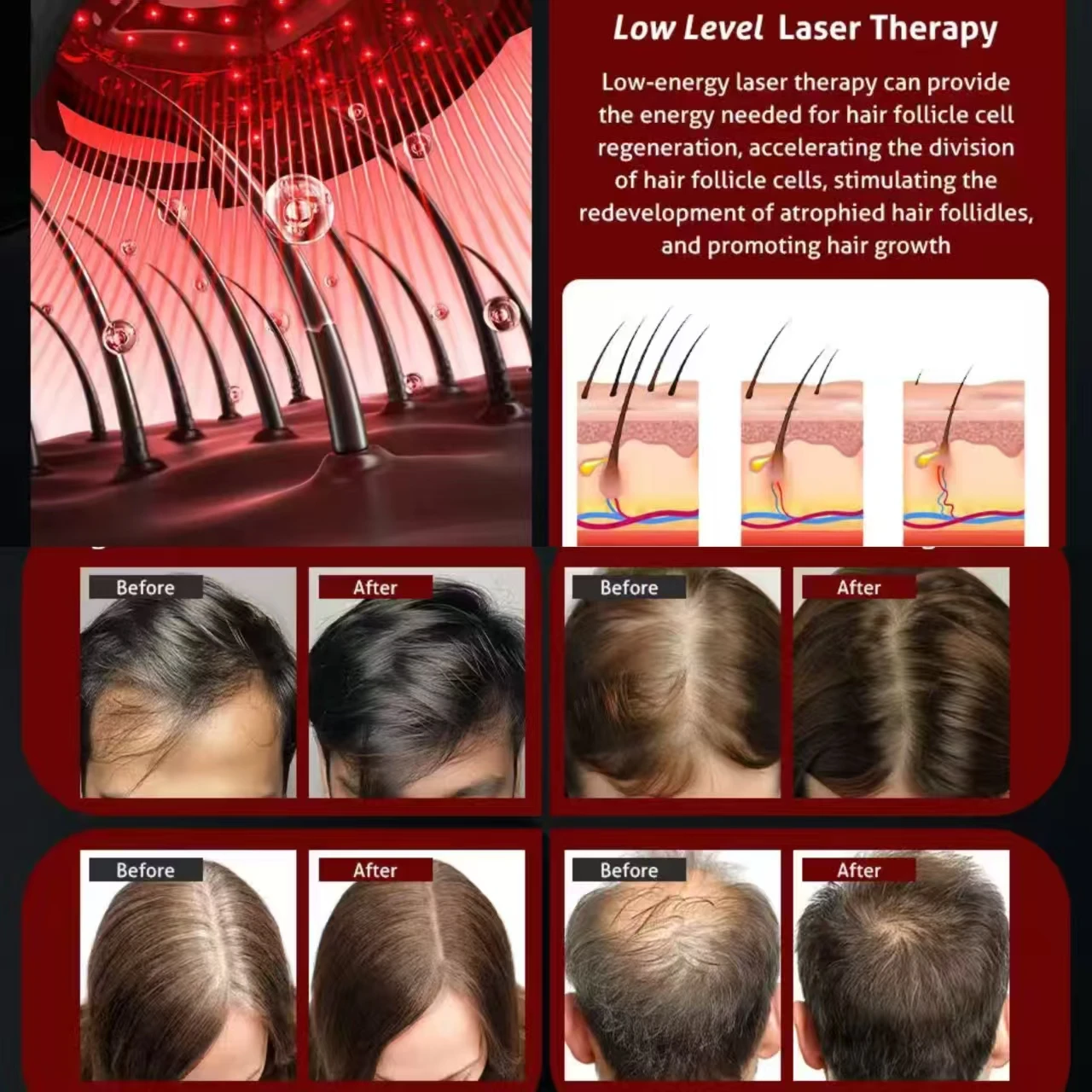 Near Infrared LED Red Light Therapy Hat 630nm 650nm for Hair Growth Cap Prevent Loss Head Relaxation Scalp Relief