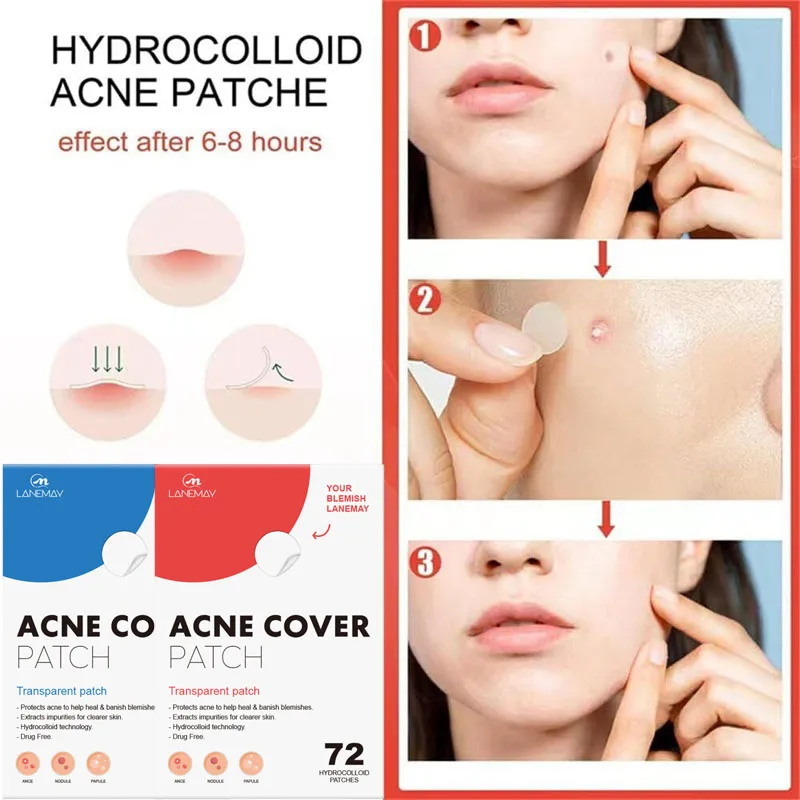 ニキビパッチ 目立たないニキビカバー 顔の油分コントロール 治療 ニキビ吸収液 透明ニキビ洗浄パッチ