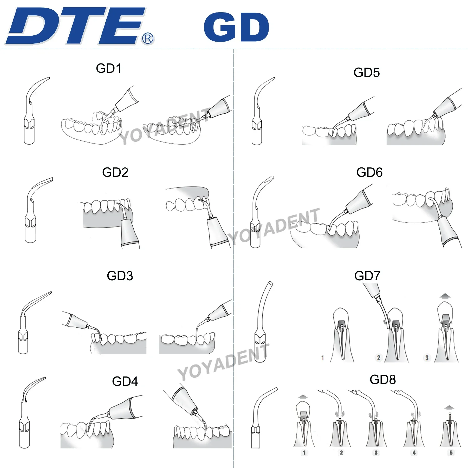 Woodpecker Tips DTE Dental Ultrasonic Scaling Tip Scaler Tips Cavity Preparation Fit NSK SATELEC ACTEON Scaler Handpiece