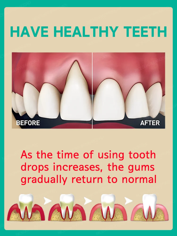 Soulage rapidement les maux de dents, répare les gencives endommagées et a des gouttes de gomme saines