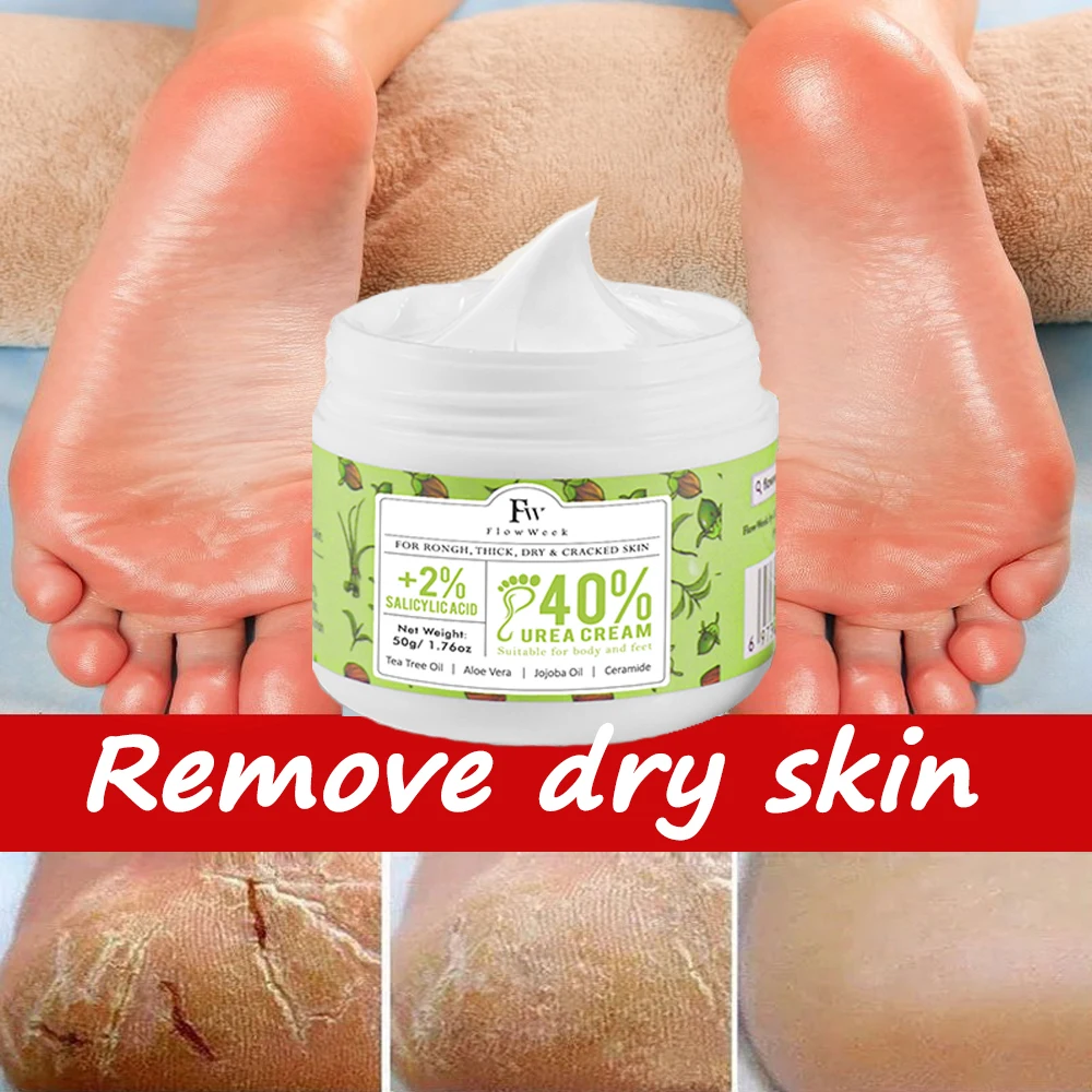 FlowWeek Urea 40% Cracked Heels Foot Cream, Salicylic Acid, Cracked Heels Repair Callus Remover, Nail Repair Urea Cream