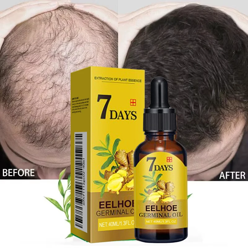 

Ginger Hair Growth Products Fast Growing Hair Essential Oil Natural Anti Hair Loss Prevent Hair Dry Frizzy Damaged Repair Care
