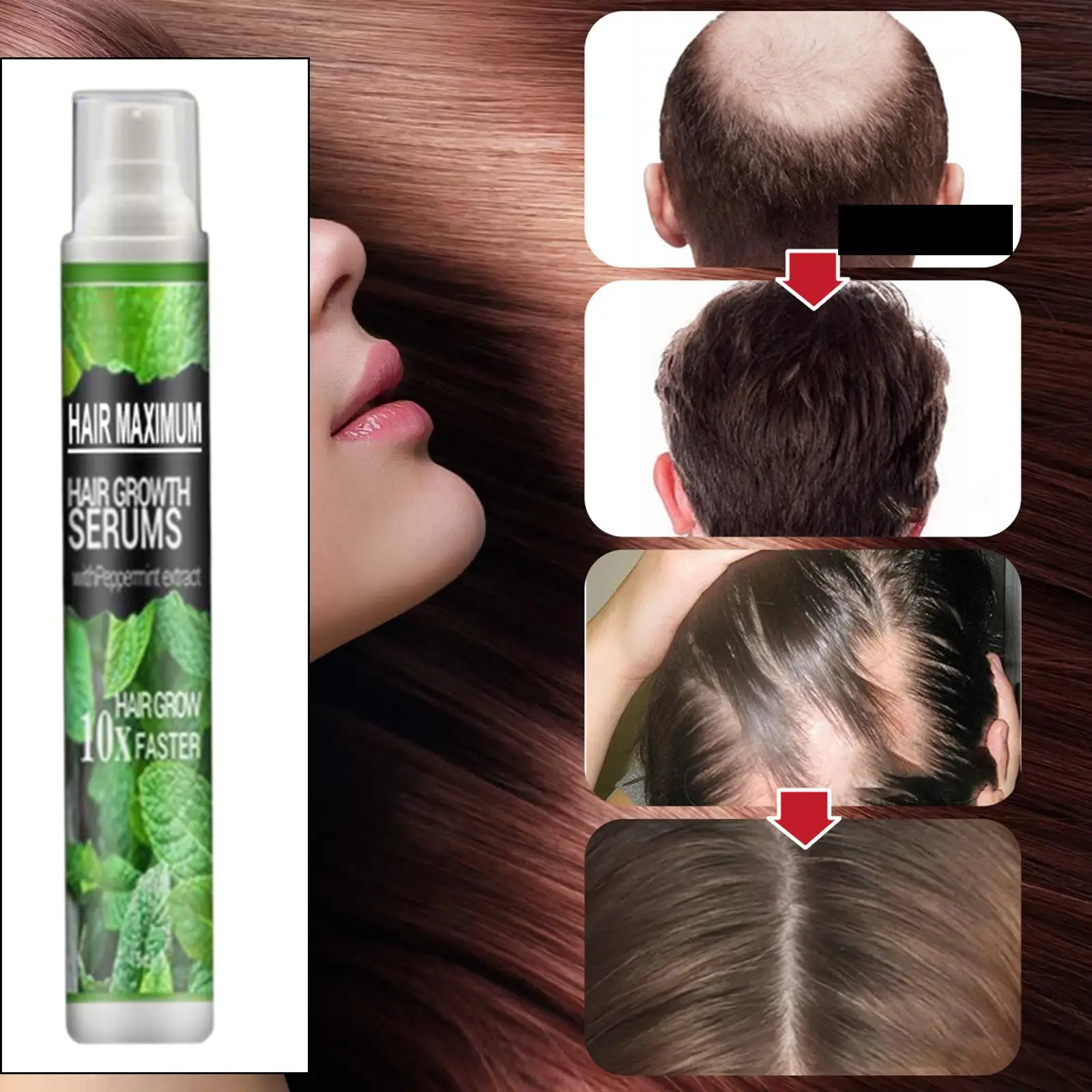 Hair-Growth Essence Spray Anti Hair Loss 10ml Longer Hair for Repair Care