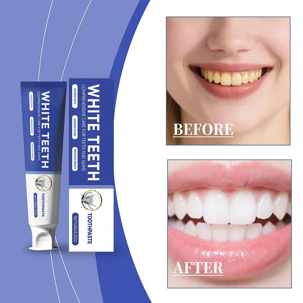 Portable 120g Nicotinamide Toothpaste Fresh Breath Clean Mouth Toothpaste Toothpaste T4E4