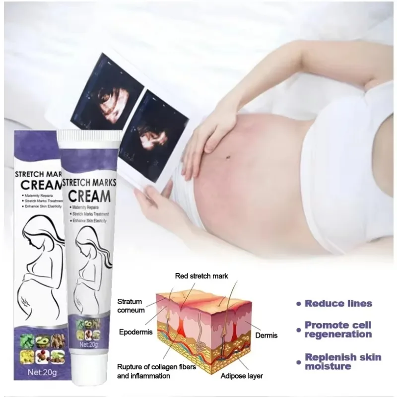 HEISSE sanfte Hautpflege verbessert die Elastizität, wirksam nach der Schwangerschaft, Entfernung von Dehnungsstreifen, leistungsstarke Mutterschaftscreme, nährt die Haut