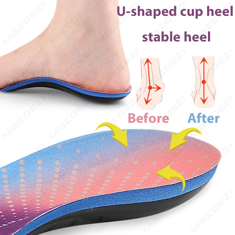 Thumbnail 3 - #26 Low Cost Heel Spurs That Work