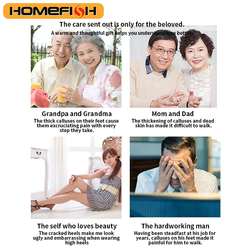 

Электрическая пилка для ног HOMEFISH, автоматическая шлифовка для удаления мозолей и огрубевшей кожи, перезаряжаемая.