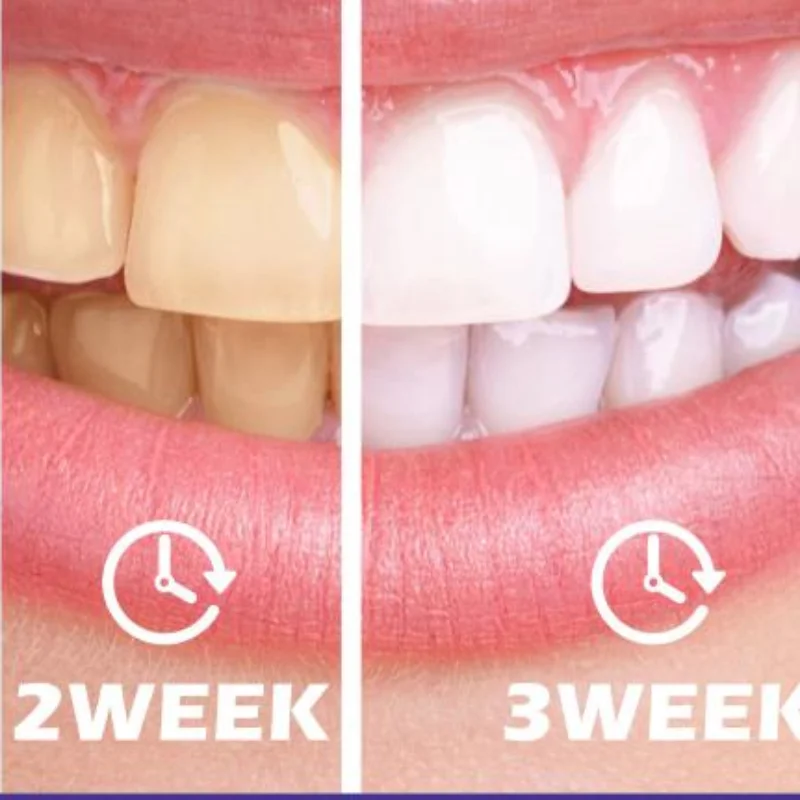 Advanced Purple Whitening Toothpaste Professional Stain Removal Odor Control Oral Care for Home Use 30ml