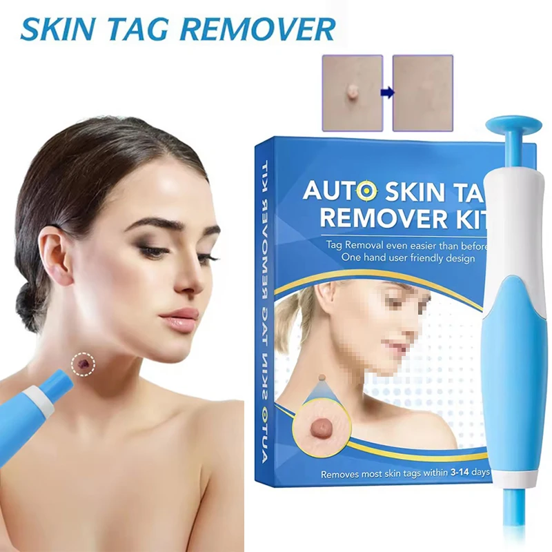 2-IN-1 Auto Skin Tag Removal Tool Kit Painless Skin Label Mole Acne Wart Removal Pen with Cleansing Swabs Facial Skin Care Tool