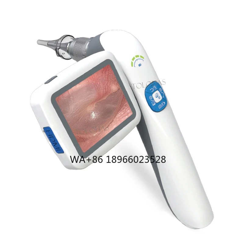 

Sinuscope Laryngoscope Portable Digital Video Ent Electronic Flexible Video